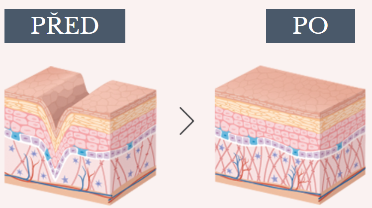 intenskin před a po intenskin před a po