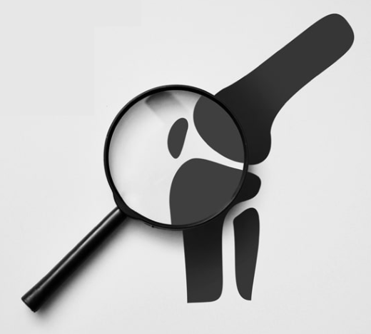 Flexavico při bolestech kloubů Flexavico při bolestech kloubů