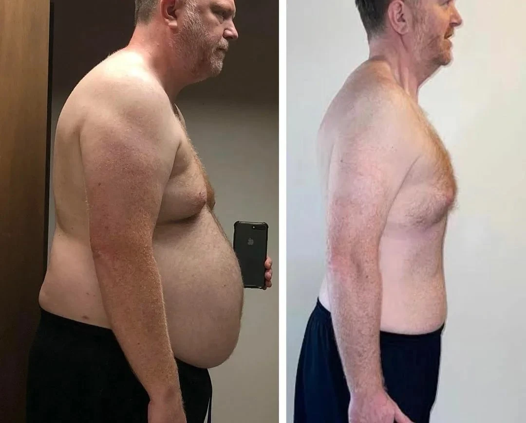 Ideal Slim na hubnutí Ideal Slim na hubnutí