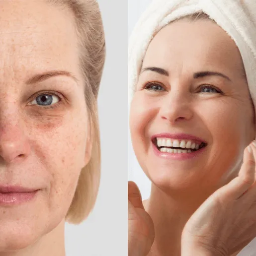 Eternelle Fine Eyelifter Serum Eternelle Fine Eyelifter Serum