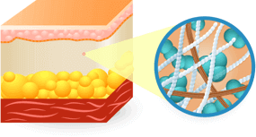 intenskin dopo l'applicazione