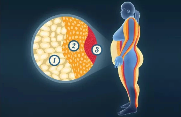 Troverno bruciare i grassi