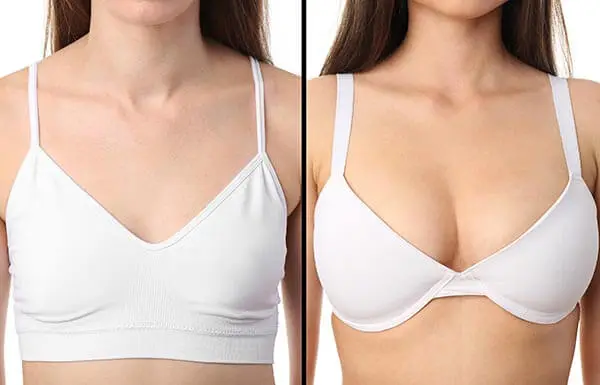 Bravona Forte before and after